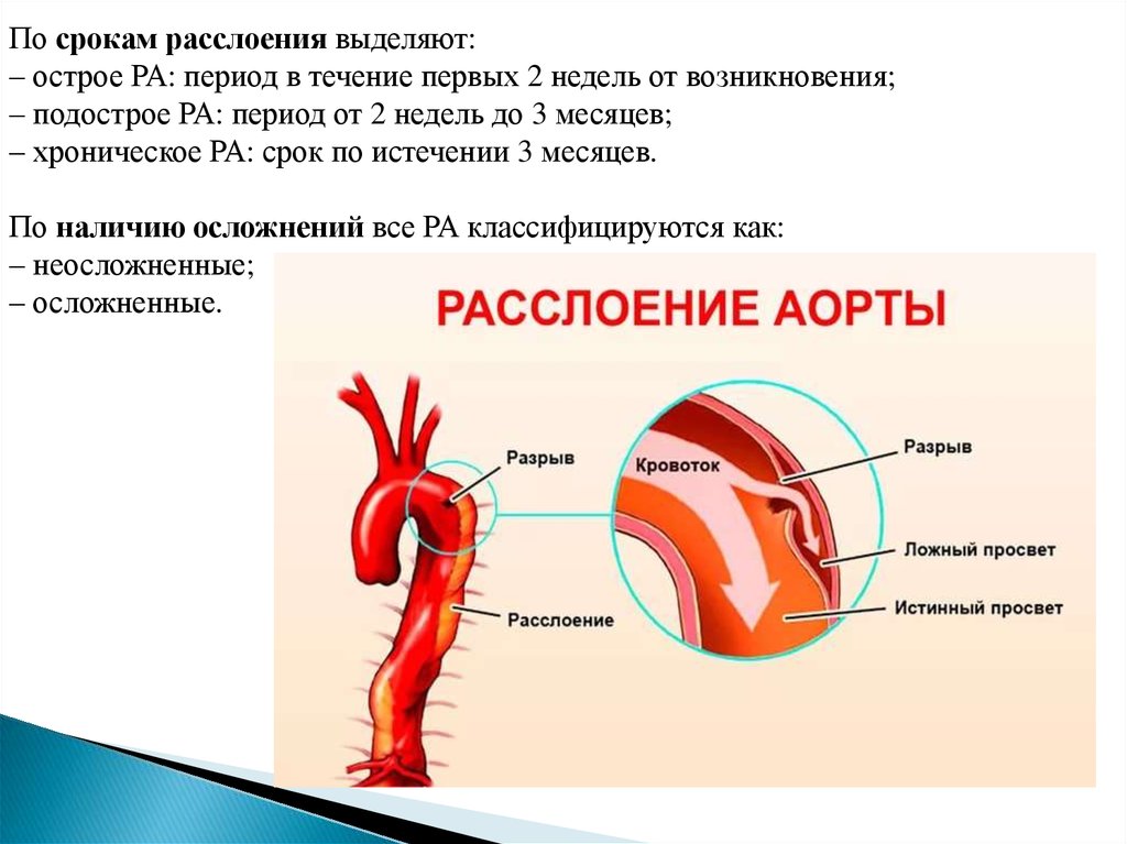 Расслаивающая аневризма карта вызова