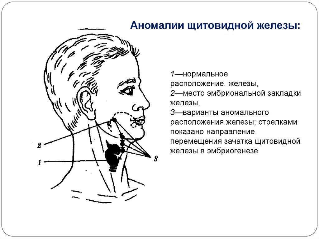 Расположение щитовидной железы у мужчин схема