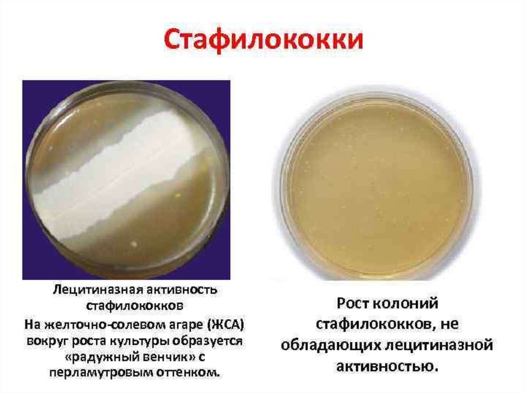 Staphylococcus aureus среда. Лецитиназа на желточно солевом агаре. Желточно-солевой агар колонии стафилококка. Стафилококк на желточно солевом агаре. Радужный венчик стафилококка на ЖСА.