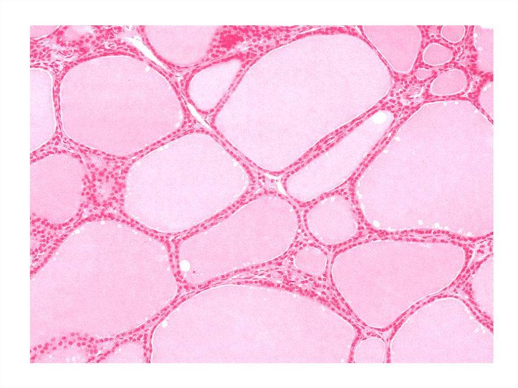 Щитовидная железа гистология рисунок