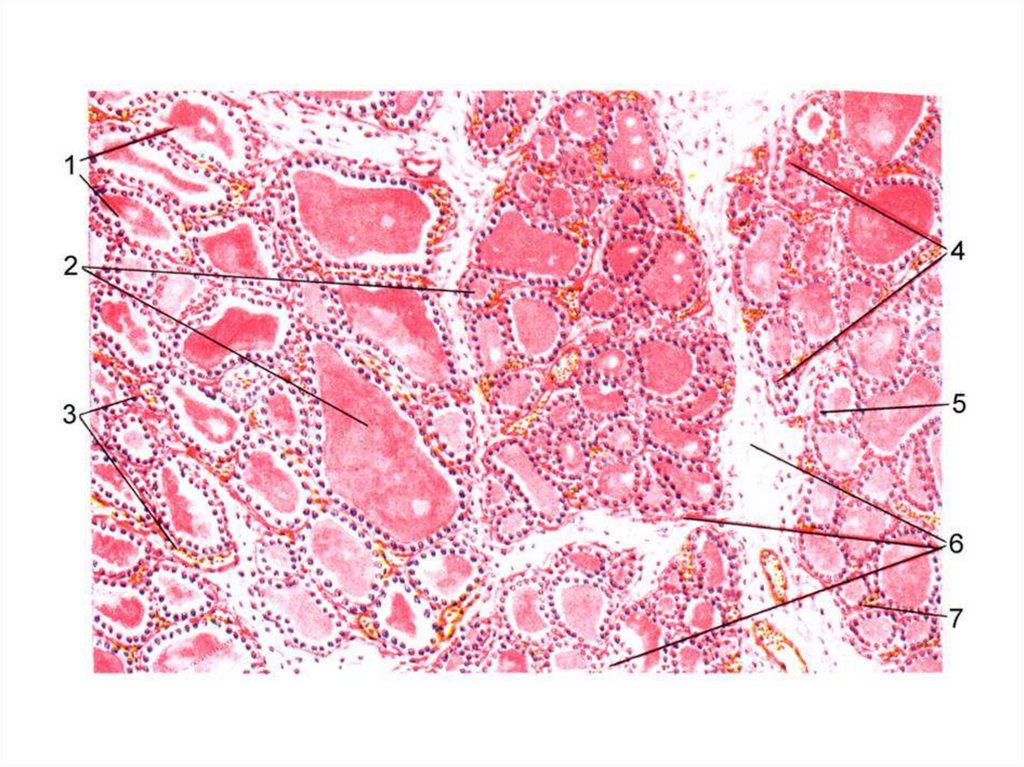 Щитовидная железа гистология рисунок