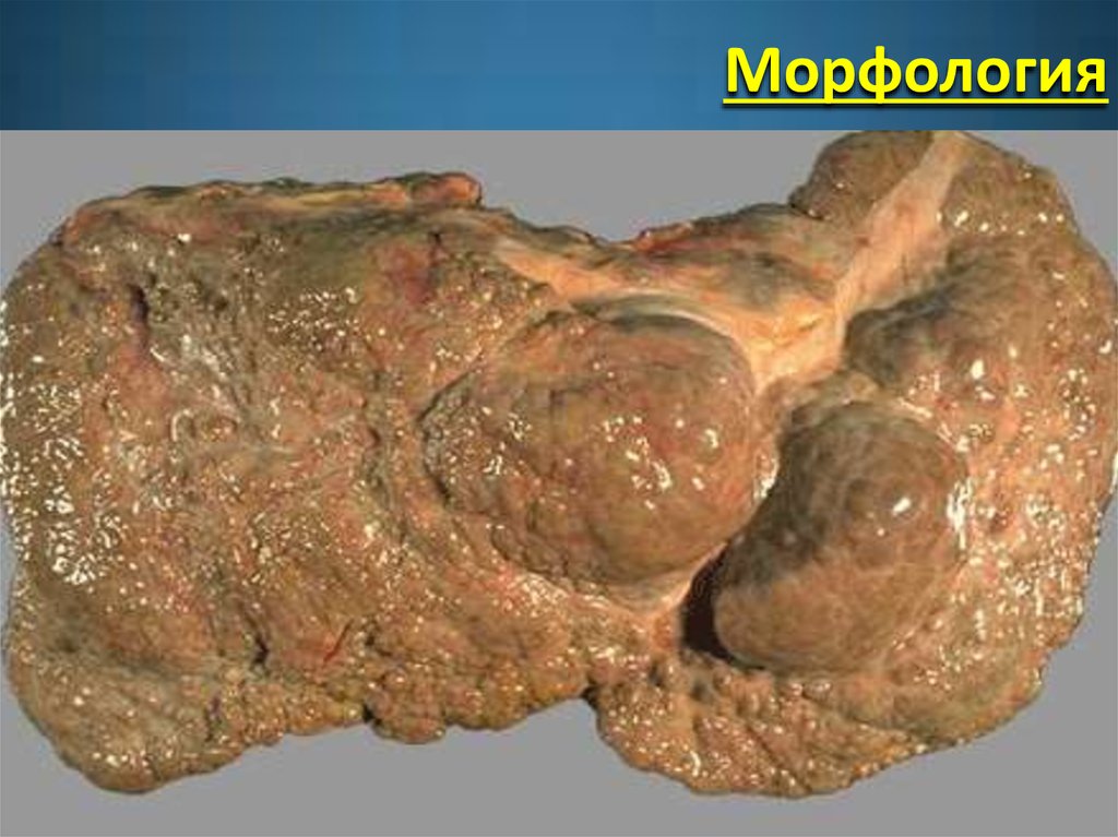 Морфология