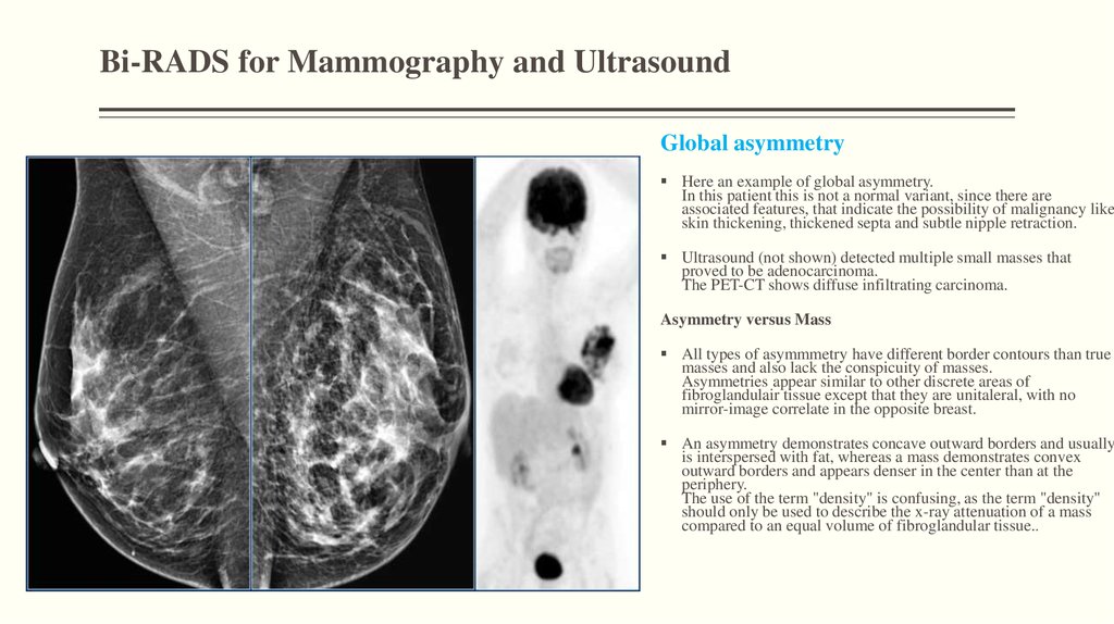 Lung rads 2. Классификация bi-rads молочных желез. ACR bi-rads. Мрт молочных желез bi-rads. Оценка маммограммы по системе bi-rads.
