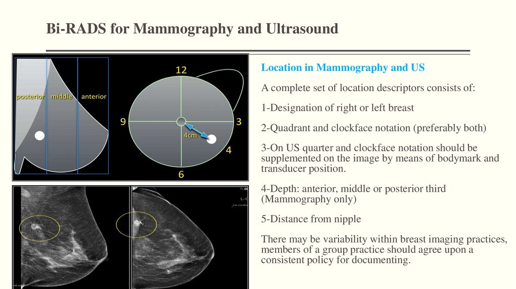 Rads 5 молочной железы что. Маммография шкала bi-rads. Классификация bi rads при УЗИ молочных желез. Маммография молочных bi-rads 2. Заключение маммографии bi-rads 1.
