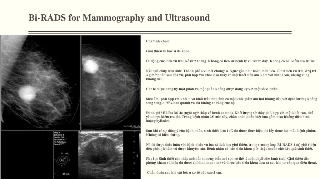 Категории маммографии. Маммография birads 4. Классификация молочной железы bi rads. Классификация bi-rads для УЗИ. Bi rads 5 на маммографии.