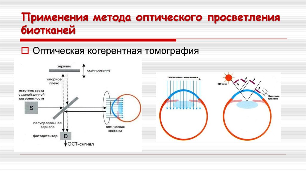 Оптическая когерентная томография схема