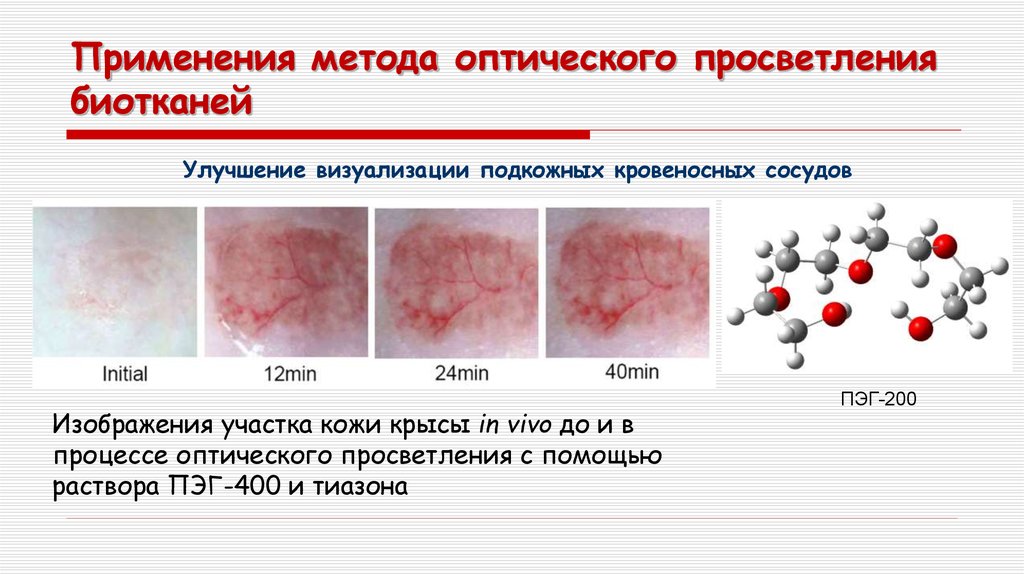Применения метода оптического просветления биотканей