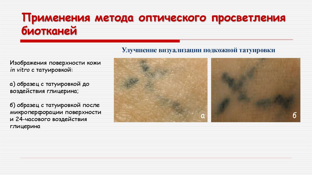 Для какого способа обработки кожи характерно наличие рисунка на поверхности