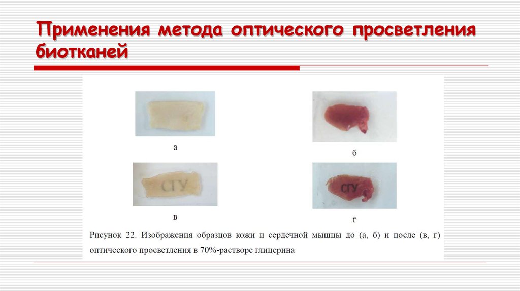 Применения метода оптического просветления биотканей