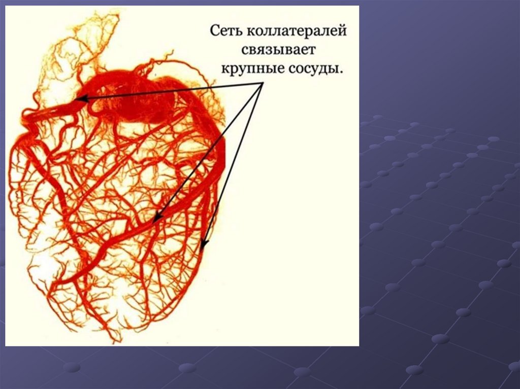 Схема коллатерального кровообращения с обозначениями