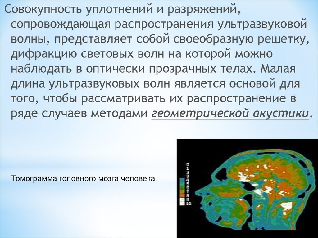 Ультразвук в природе и технике доклад. Ультразвуковые волны представляют собой.