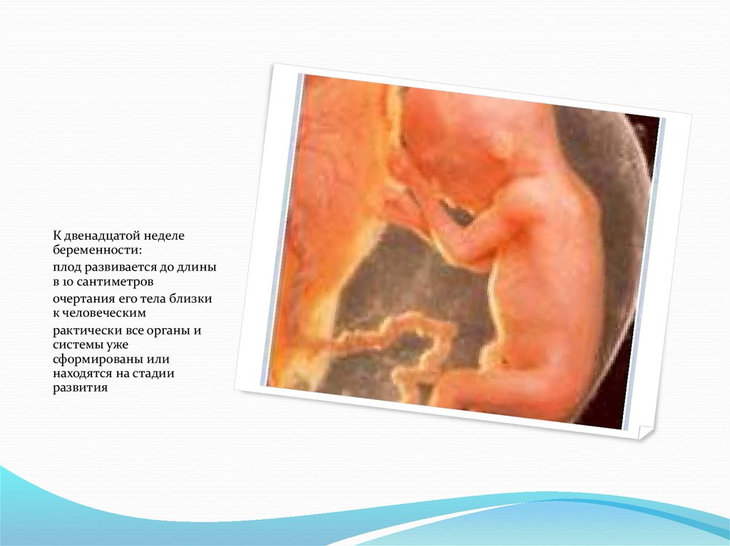 Роды на 12 неделе. Эмбрион на 12 неделе беременности. Размер зародыша в 12 недель. Эмбрион на 11 неделе беременности.