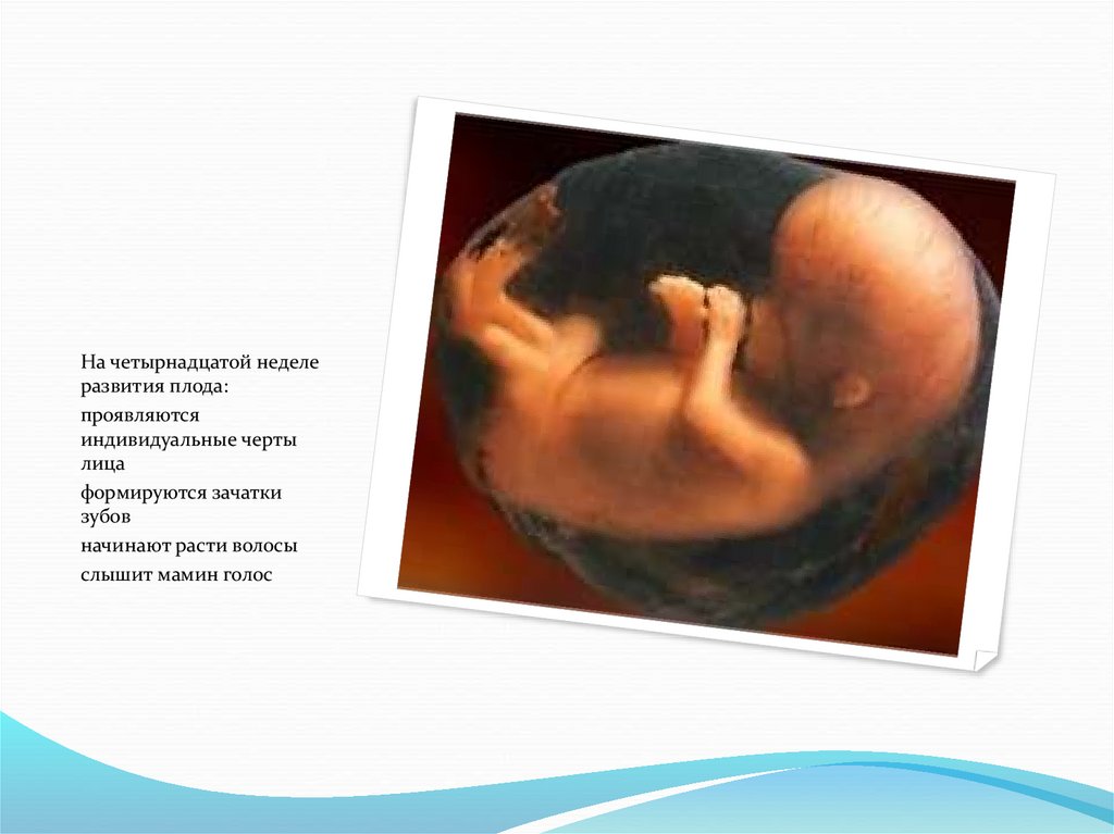 14 неделя 3 дня. Эмбрион 13-14 недель Размеры. Размер зародыша в 14 недель беременности. Недели беременности 14 недель. Плод на 14 неделе беременности.