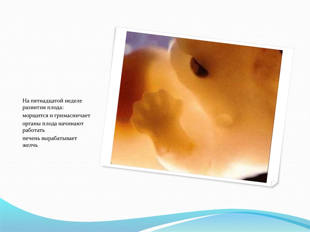 Роды 15 недель. Половые органы у эмбриона на 9 неделе. 15 Недель беременности. При беременности плод поглощает другой плод. Фото 3д в 15 недель беременности расщелина губы в профиль 15 недель.