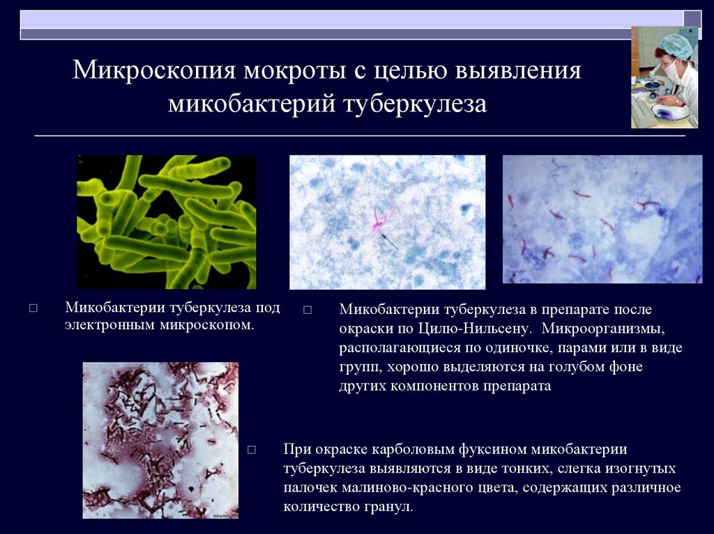 Палочки в мокроте. Микроскопия мокроты на микобактерии. Микобактерии методы микроскопии. Методы выявления микобактерий туберкулеза в мокроте. Микроскопическое исследование мокроты на туберкулез.