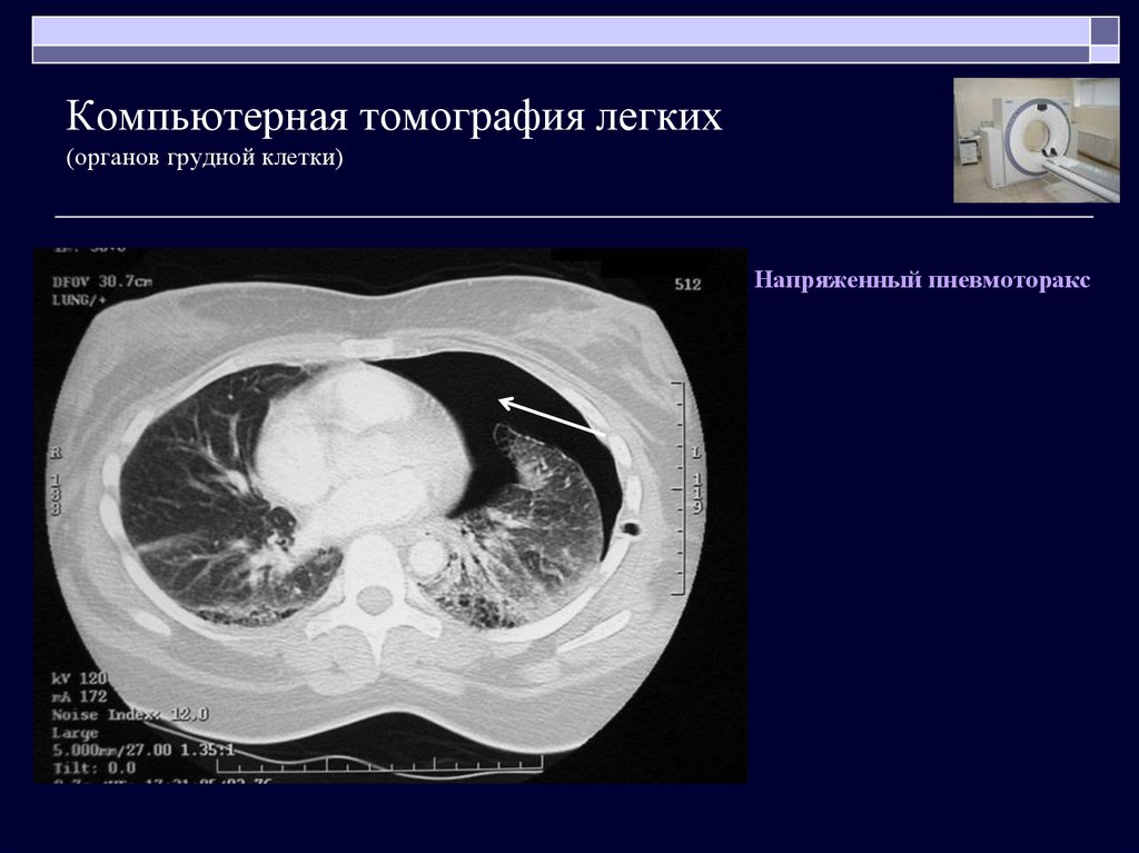 Кт легких презентация