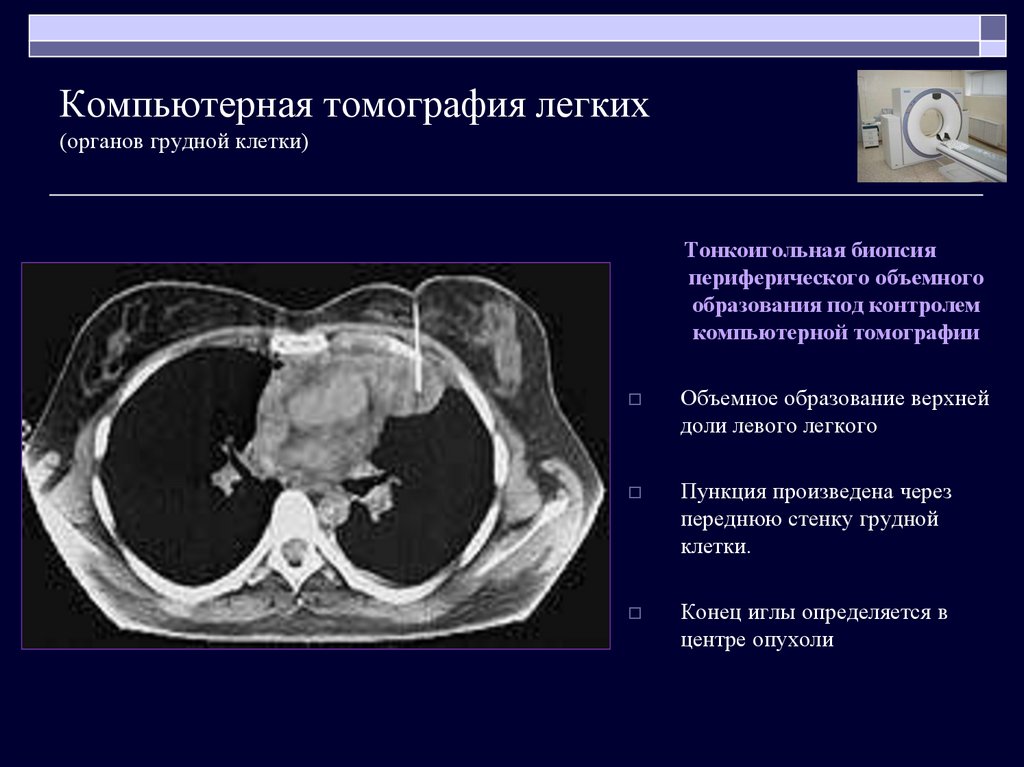 Кт клетки. Кт легких презентация. Кт органов грудной клетки (лёгких). Образование грудины кт. Кт легких органы.