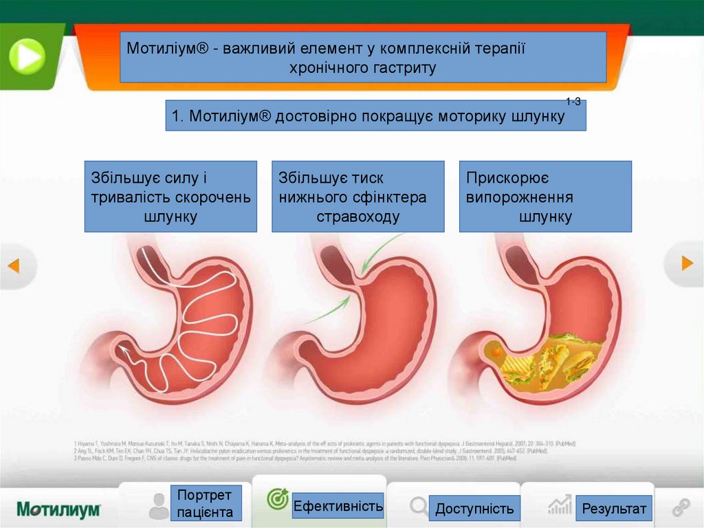 Мотиліум® - важливий елемент у комплексній терапії хронічного гастриту ...
