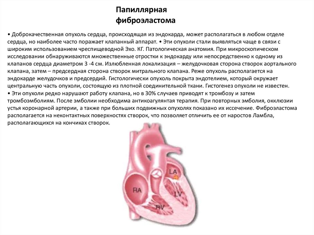 Рабдомиома сердца. Опухоли сердца сосочковые фиброэластомы. Папиллярная фиброэластома сердца. Первичные опухоли сердца. Опухоли сердца презентация.
