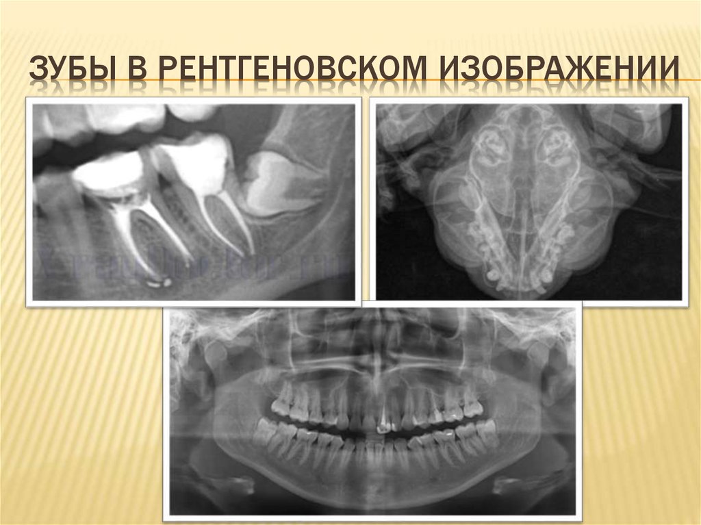 Зубы в рентгеновском изображении