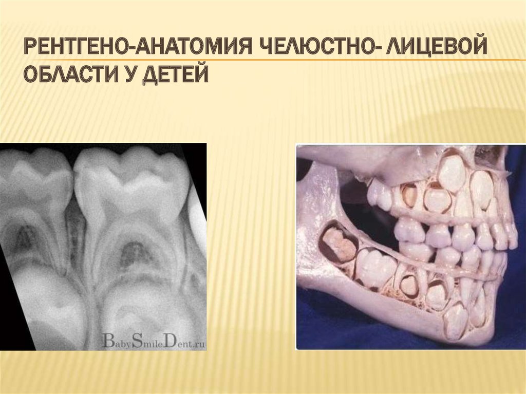 Рентгено-анатомия челюстно- лицевой области у детей