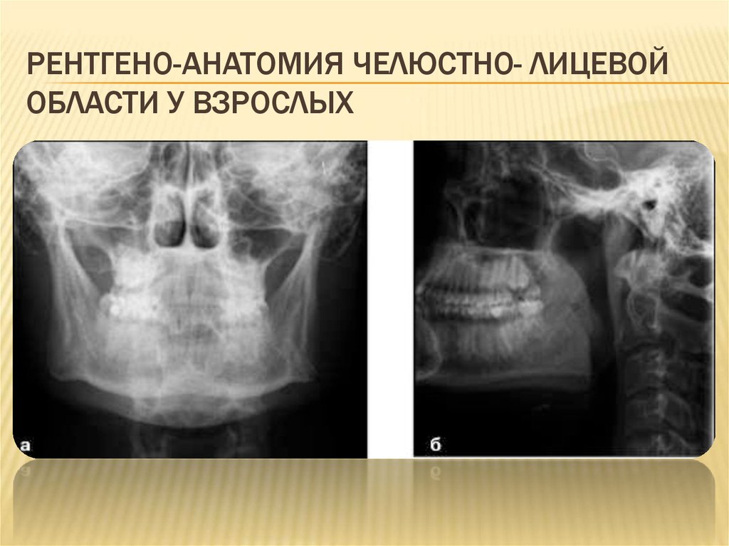Лучевое исследование челюстно лицевой зоны презентация