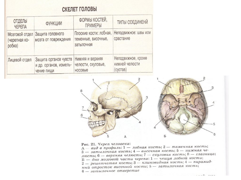 Шов между теменными костями. Основание черепа вид сбоку. Кости мозговой части черепа человека.