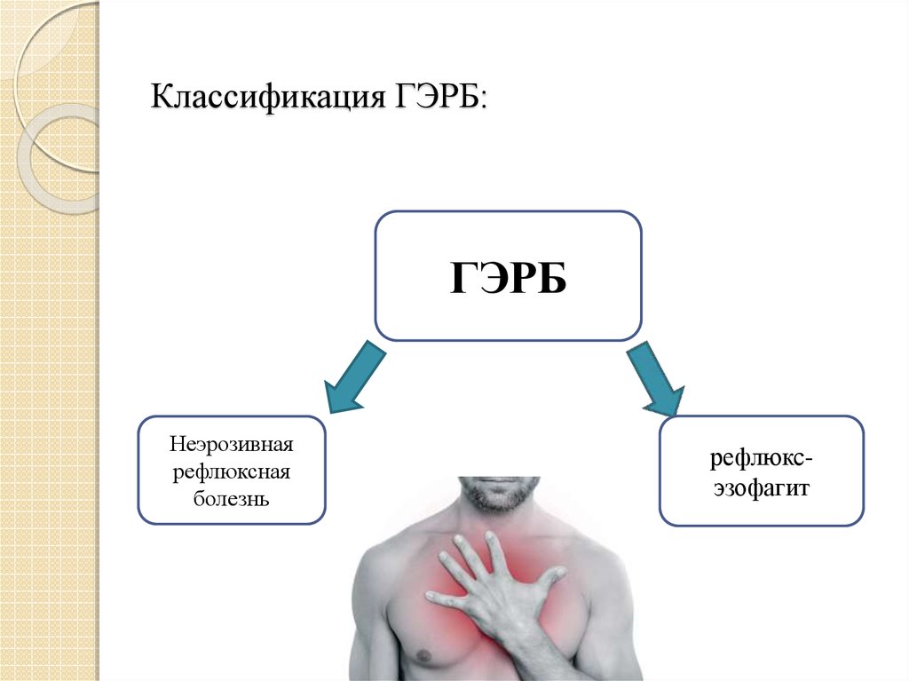 Обострение гэрб на фоне стресса