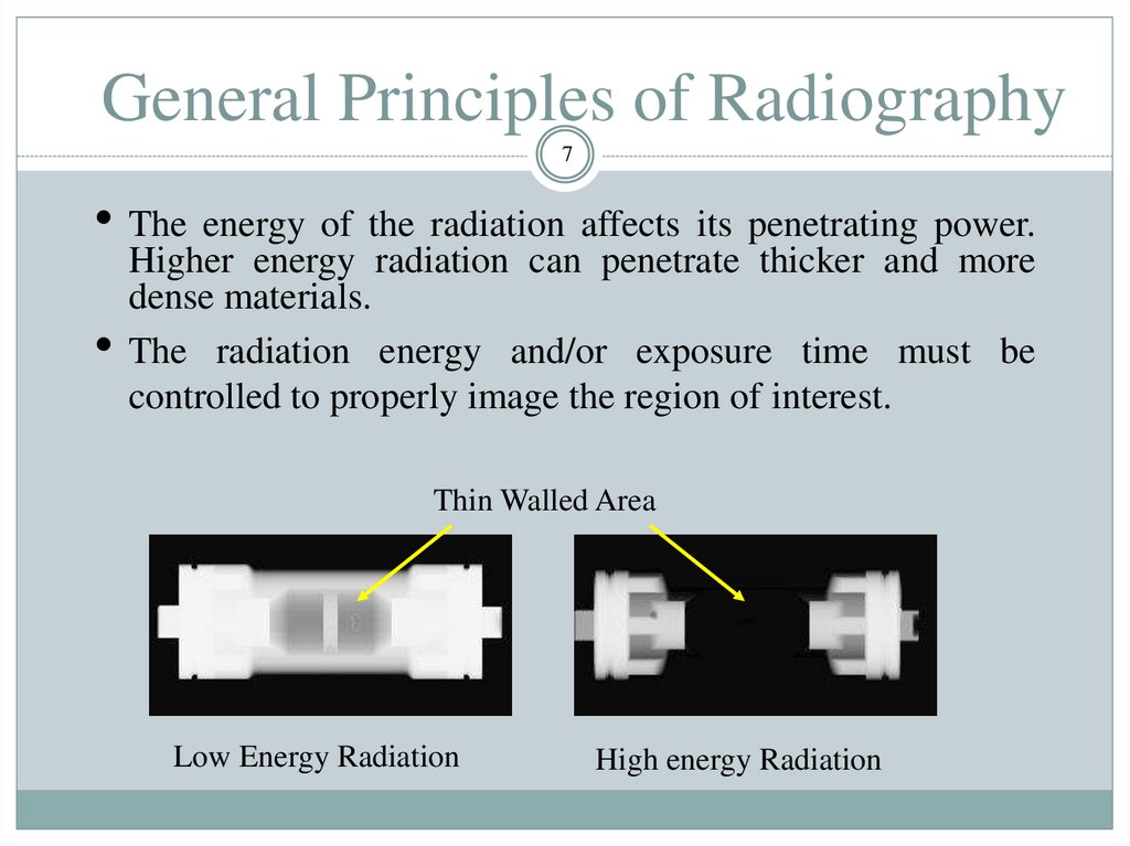 General Principles of Radiography