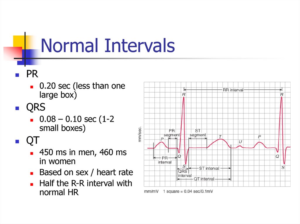 Ecg Normal Values In Ms Printable Templates Protal