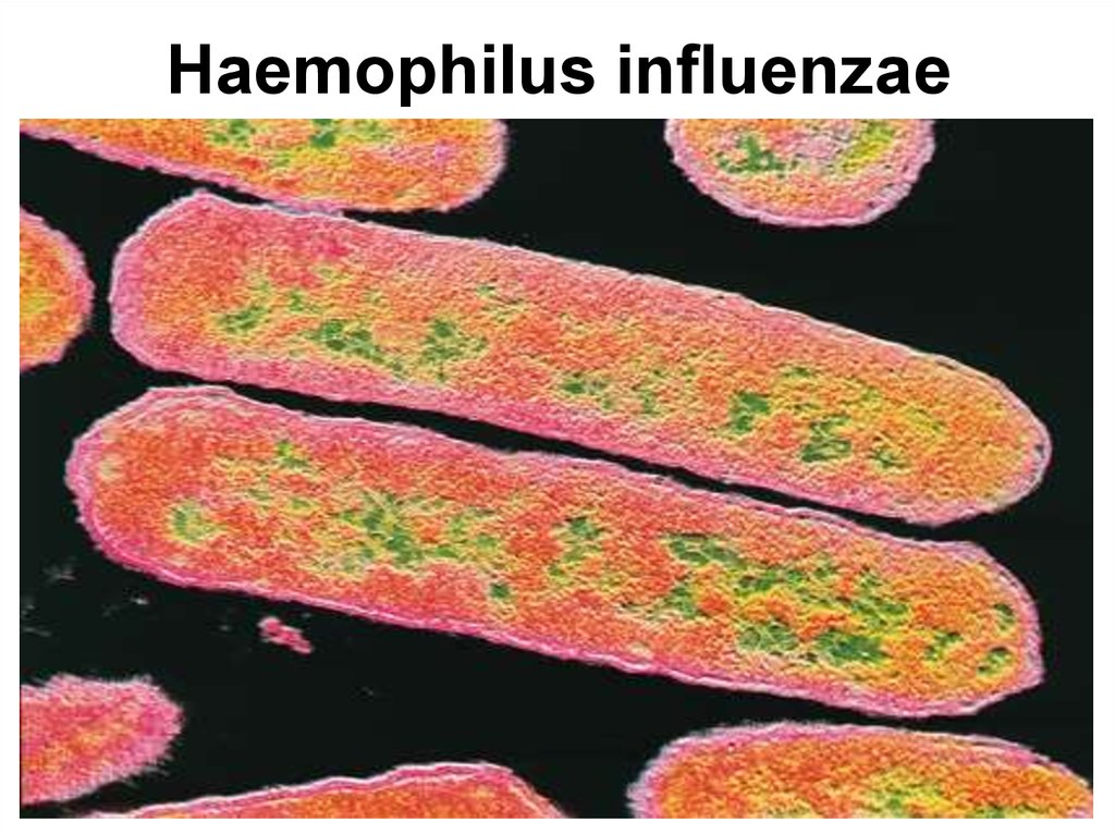 Haemophilus influenzae 10. Haemophilus influenzae (палочка Пфайфера). Бактерий палочка гемофильная палочка. Бактерии Haemophilus influenzae. Капсула бактерии гемофильная палочка.