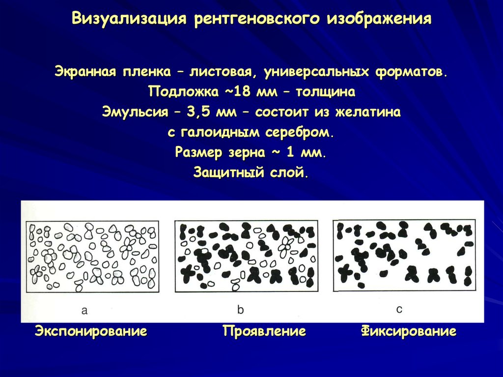 Изображение получаемое на рентгеновской пленке