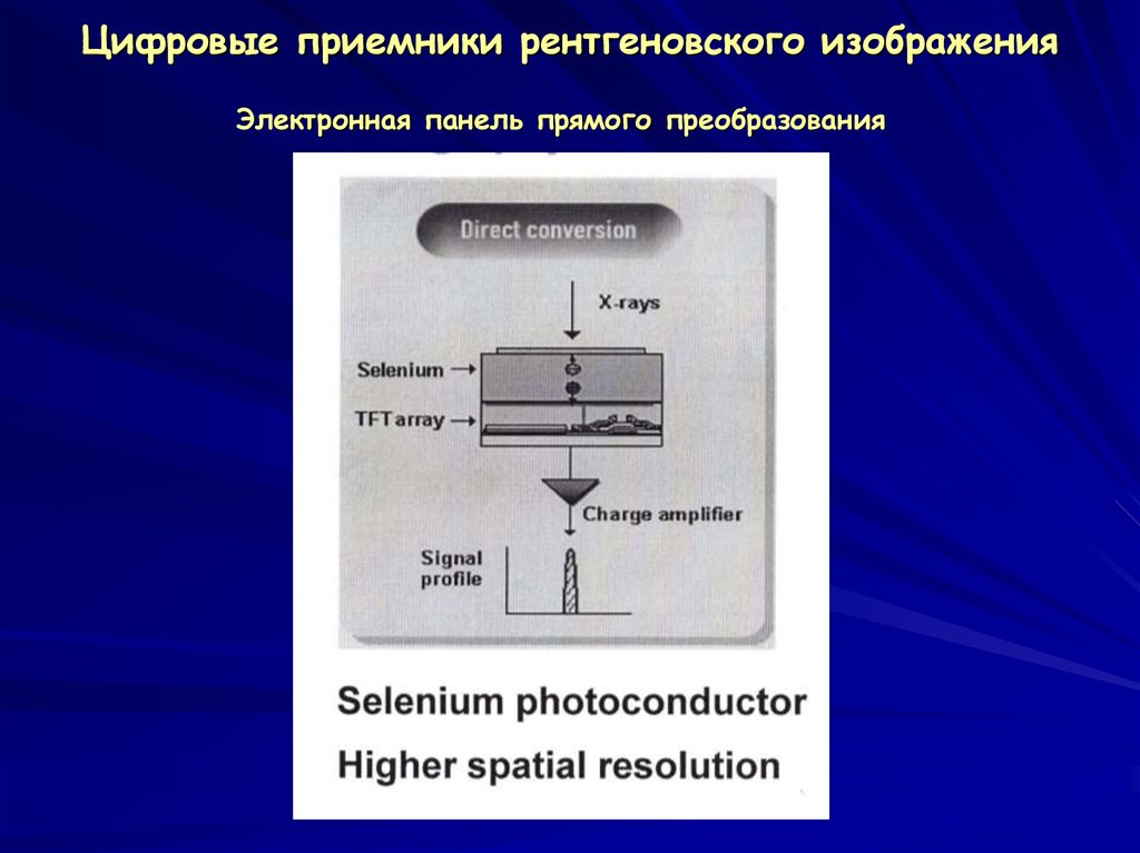 Усилитель рентгеновского изображения