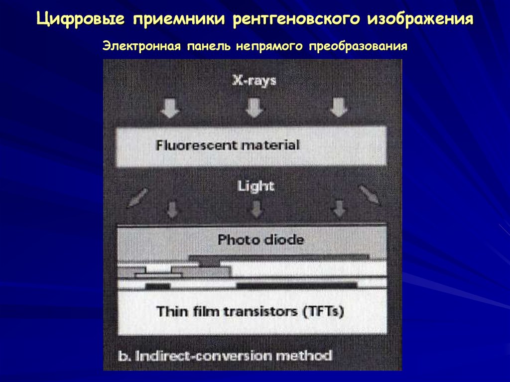 Цифровое рентгеновское изображение