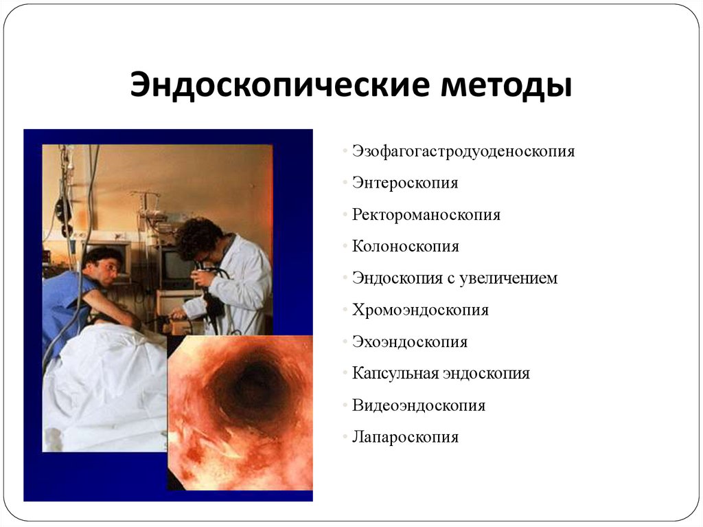 Эндоскопические методы исследования жкт презентация