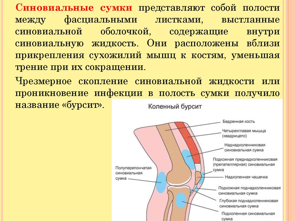 Синовиальная сумка фото