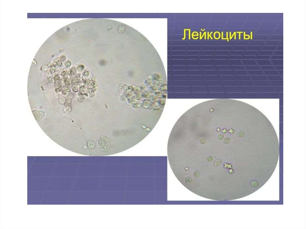 Эритроциты в моче фото под микроскопом