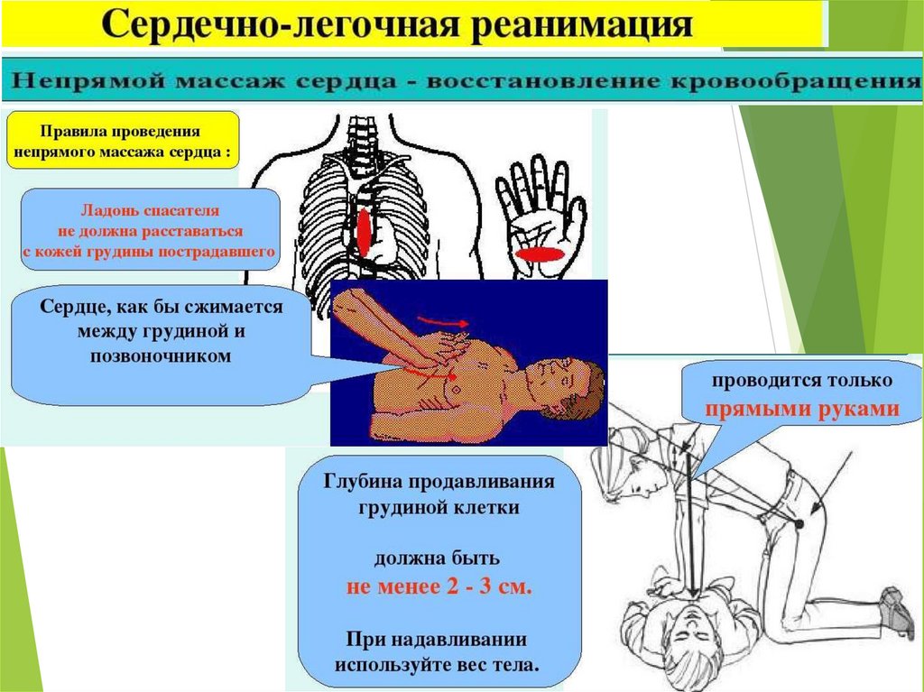 Первая помощь при остановке сердца презентация