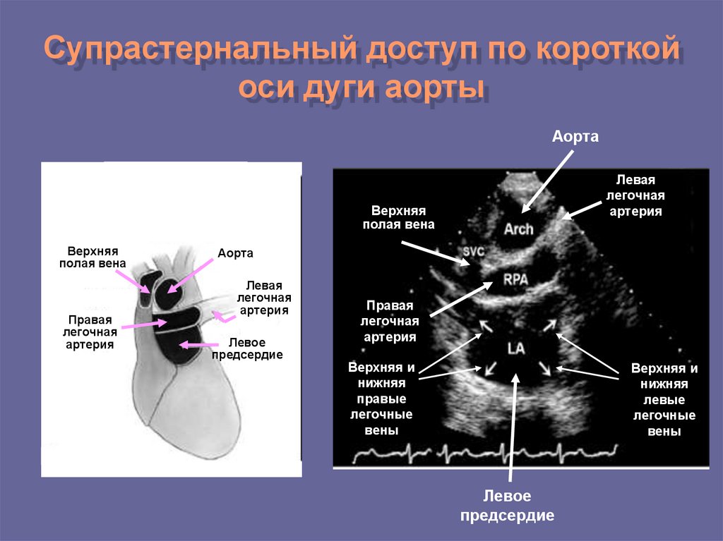 Длинная ось