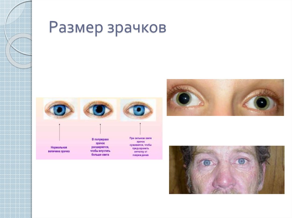 Средний размер глаз. Форма зрачков у человека в норме. Норма расширения зрачка. Размер зрачка в норме. Диаметр зрачка в норме.