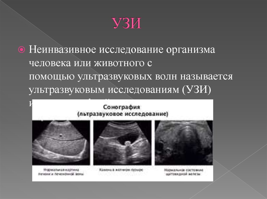 Узи презентация в медицине