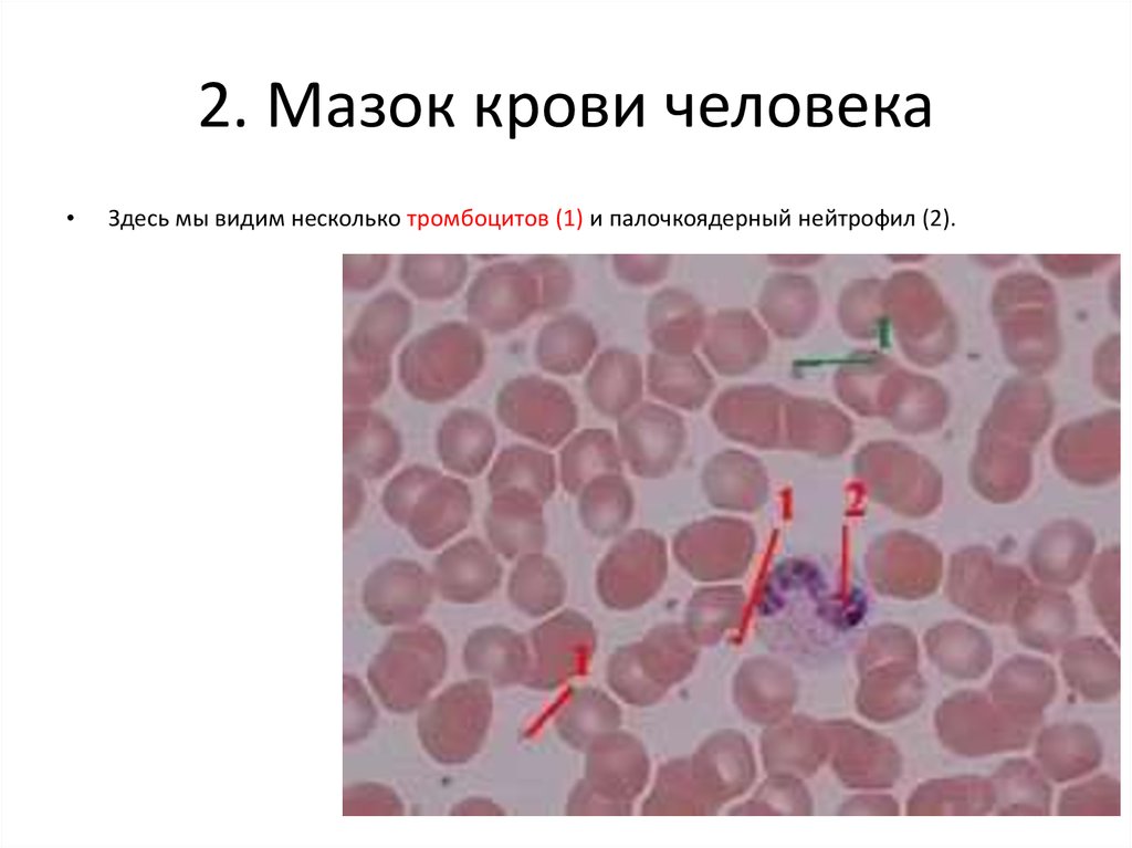 Тромбоциты в мазке крови фото