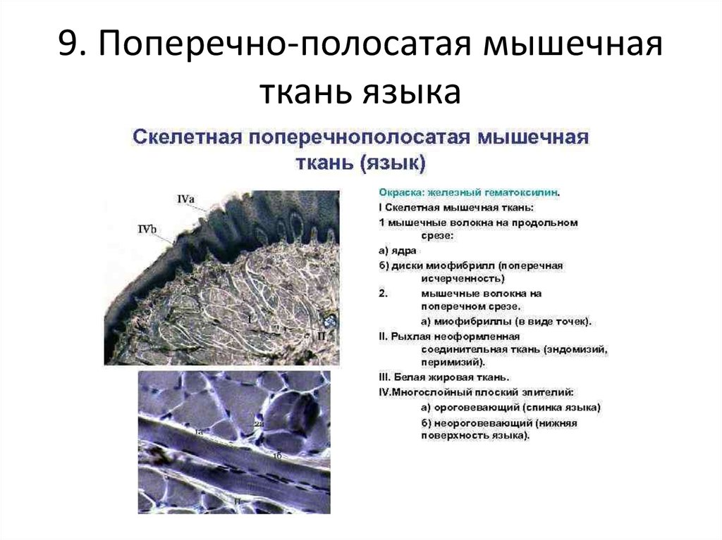 Ткань языка. Поперечнополосатая Скелетная мышечная ткань языка препарат. Поперечно полосатая мышечная ткань языка кролика. Поперечнополосатая Скелетная мышечная ткань языка кролика. Поперечнополосатая мышечная ткань языка кролика.