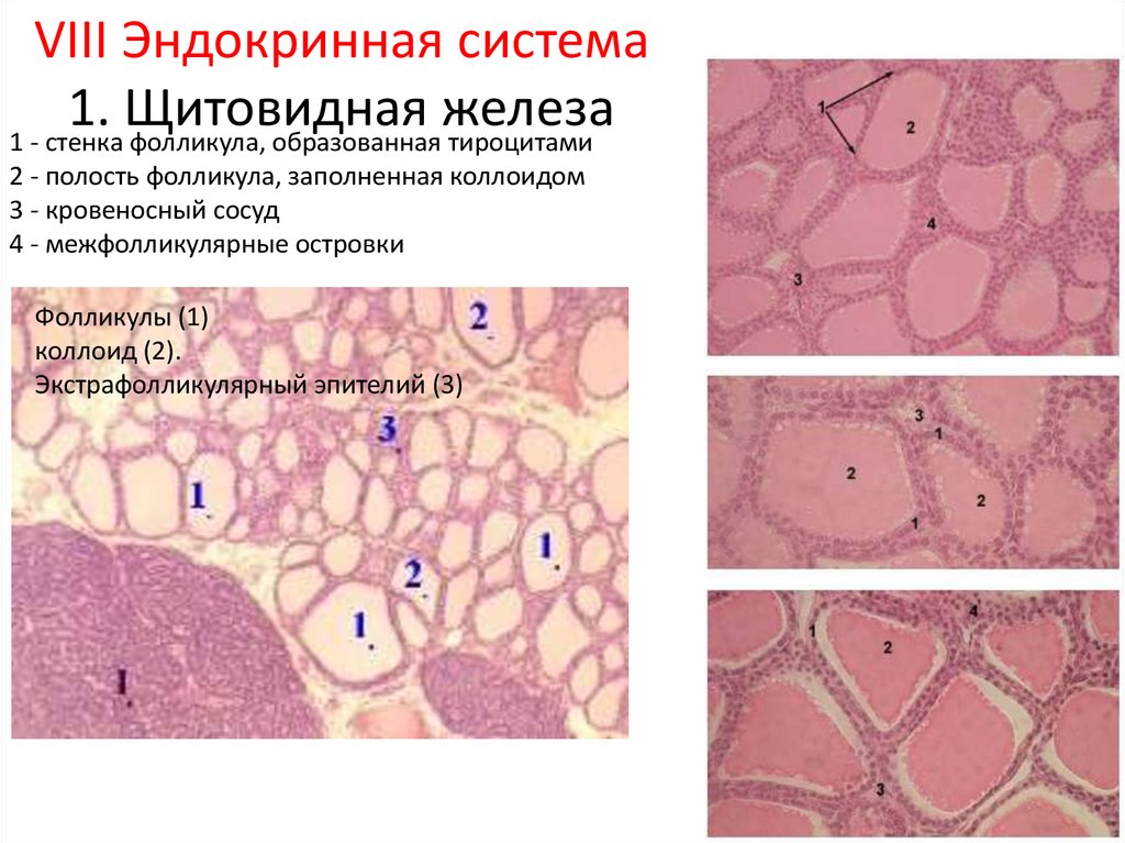 Щитовидная железа фолликулы