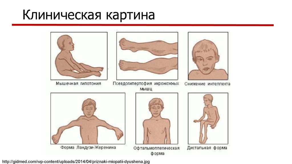 Клиническая картина