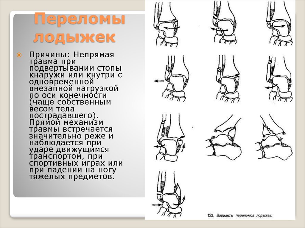 Вывих стопы карта вызова