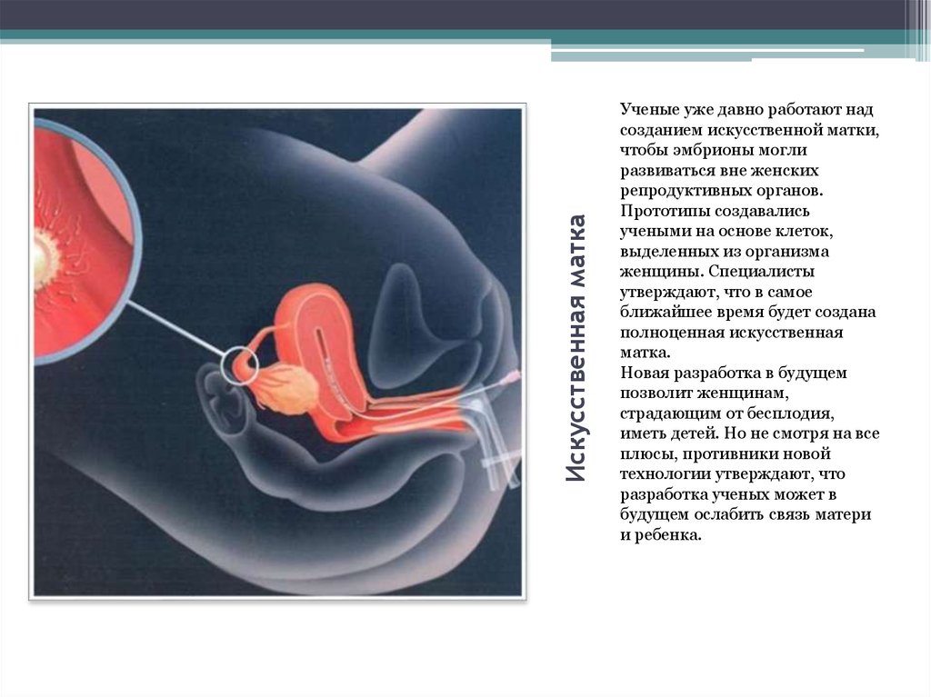 Проект искусственная матка