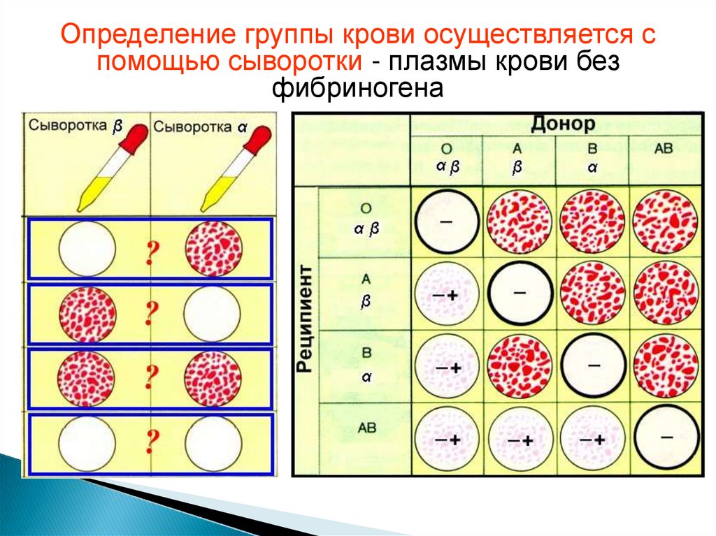 Схема переливания плазмы крови