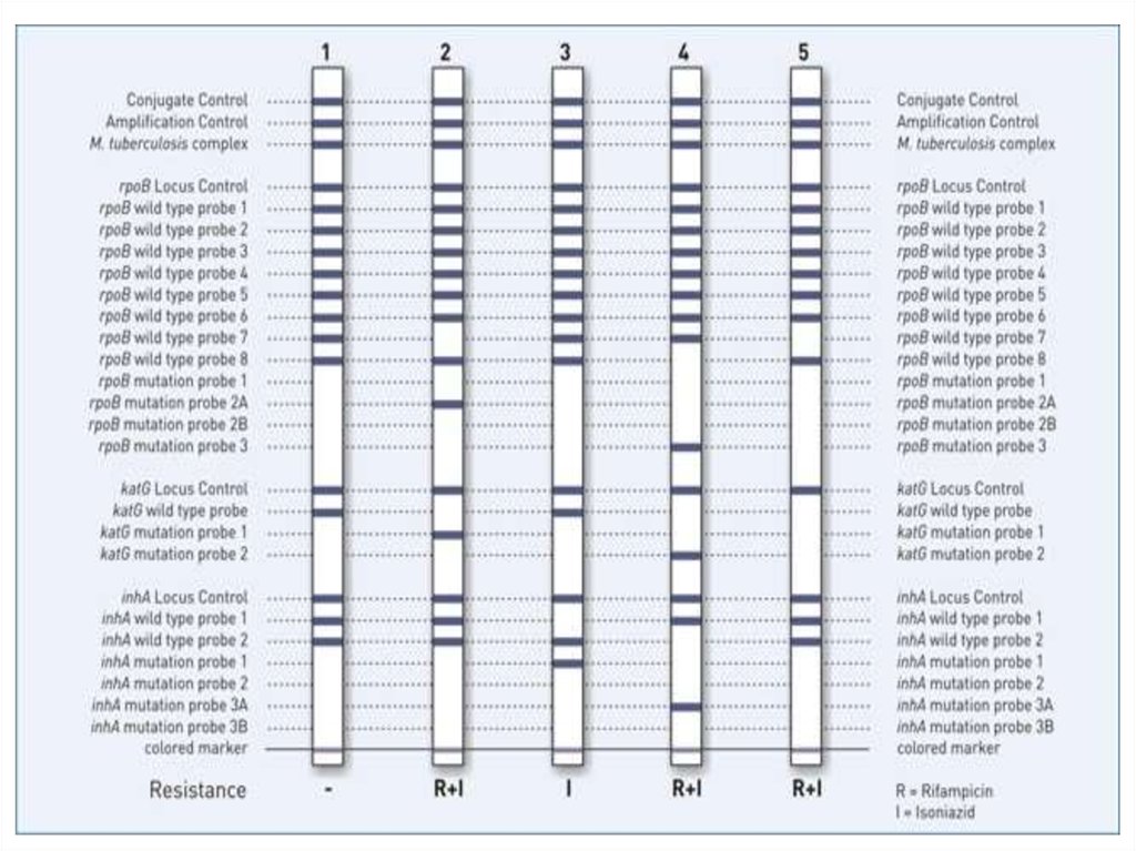 Finclass info wt cybergram. Genotype MTBDRPLUS. Набор genotype® MTBDRPLUS. Genotype (Hain) Rif.