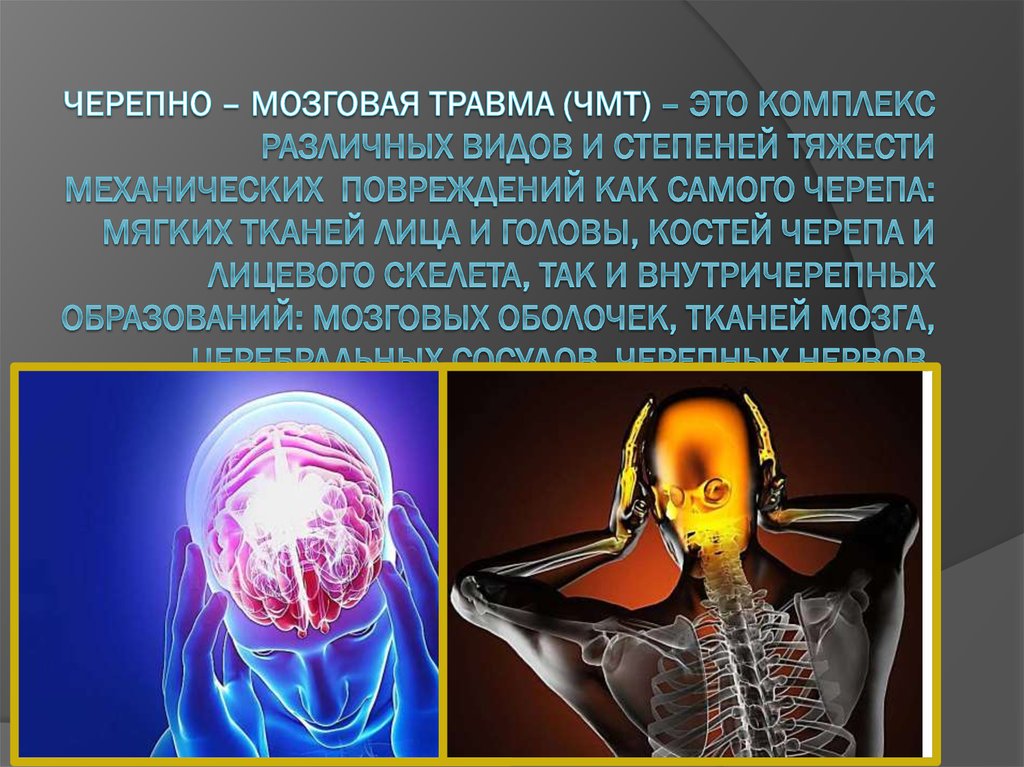 Закрытая черепно. Черепно-мозговая травма. Черепа-могговая травма. Профилактика черепно-мозговой травмы. Биомеханика черепно- мозговой травмы.